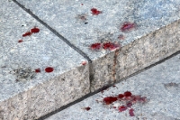 Blutspuren auf den Stufen an einem Brunnen in Poznan